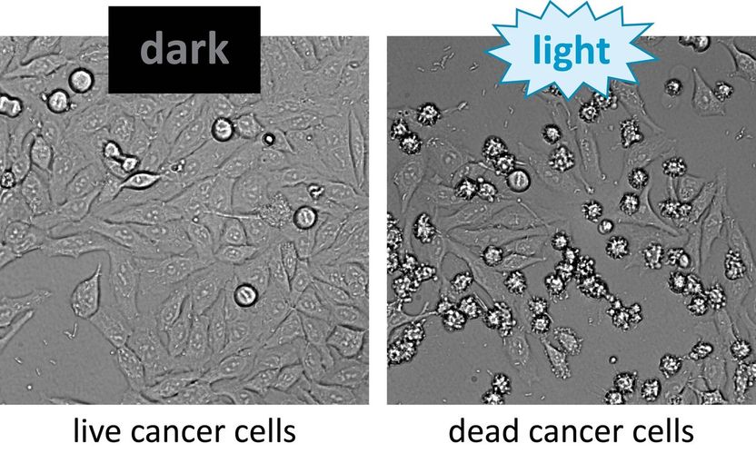 © Max Planck Institute for terrestrial Microbiology/Diepold