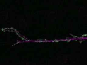 CSIC-Forscher finden die Rolle eines Proteins bei der Regulation der Synapsenbildung