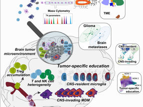 Mapeo de las células inmunes en los tumores cerebrales