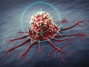 Tracking cancer's immortality factor