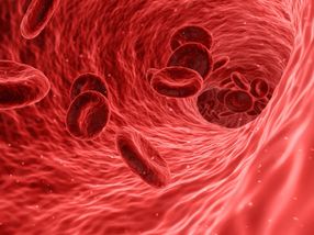 How a microRNA protects vascular integrity