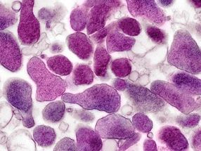 Descrita la maquinaria de infección de una bacteria genital resistente a los antibióticos