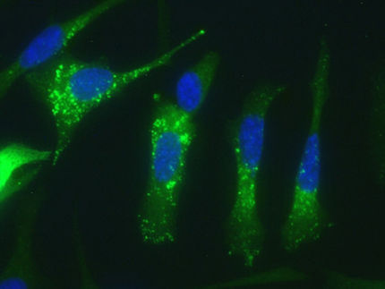 Un estudio con investigadores del CSIC identifica una nueva vía para atacar a las células tumorales