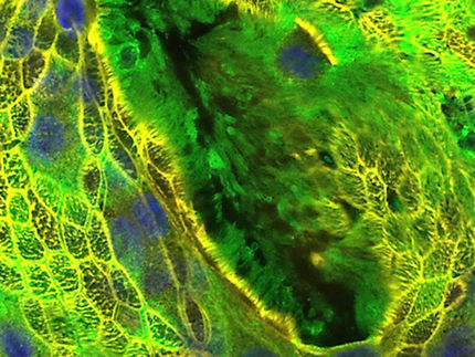 Wie sich COVID-19 in der 3D-Zellkultur simulieren lässt