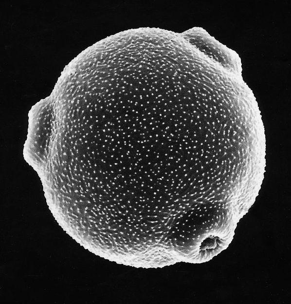 I. Weichenmeier/Zentrum für Allergie & Umwelt