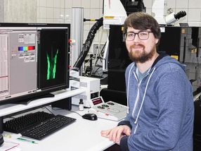 Forscher der Universität Bayreuth entdecken außergewöhnliche Regeneration von Nervenzellen