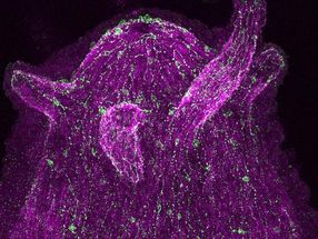 Eine Neuronenpopulation in Hydras diffusem Nervennetz exprimiert Neuropeptide (in grün), die mittels spezifischer Antikörper sichtbar gemacht werden. Die Zellkerne sind in Magenta eingefärbt.