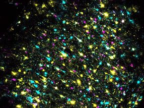 A section of mouse brain stained to identify individual neurons and all their connections. Each color represents a different DNA barcode.