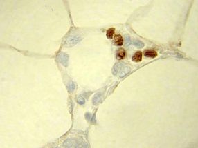 Diabetes-Medikament hemmt gefährliche Entzündung des Fettgewebes