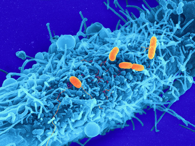 © MPI f. biophysikalische Chemie, Christian Goosmann, Diane Schad, Rashmi Gupta und Michael Kolbe