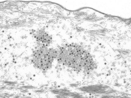 The wrong track: how papillomaviruses trick the immune system