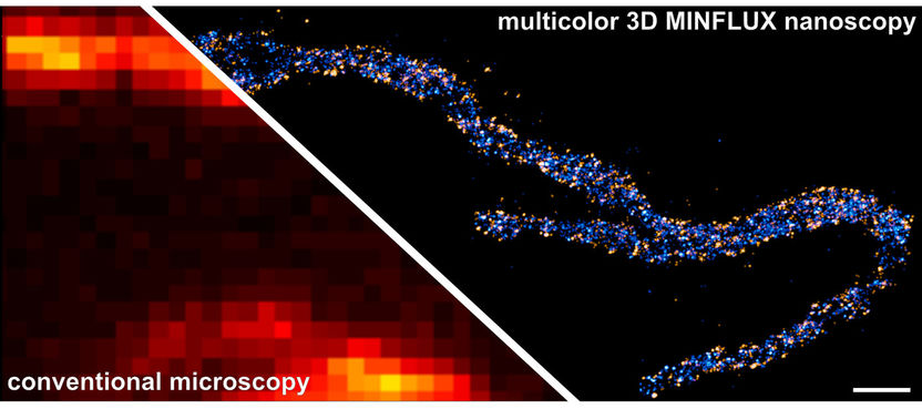 © Till Stephan & Jasmin Pape / Max Planck Institute for Biophysical Chemistry