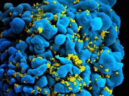La droga para la esclerosis múltiple bloquea la infección y la transmisión del VIH en las células inmunes humanas