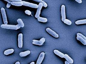 Un salto adelante en la lucha contra la resistencia a los antibióticos