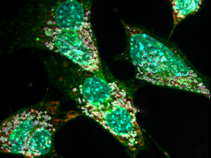 Los cristales de grasa desencadenan una inflamación crónica