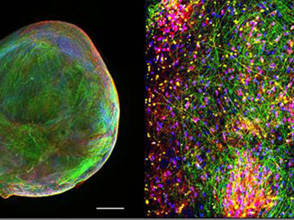 Generation of human brain organoids with the ability to learn