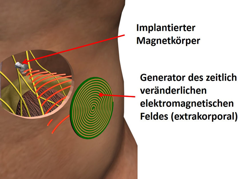 Fraunhofer IBMT