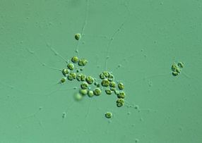 Zweite Algenart mit rätselhaften Chloroplasten-Komplexen entdeckt