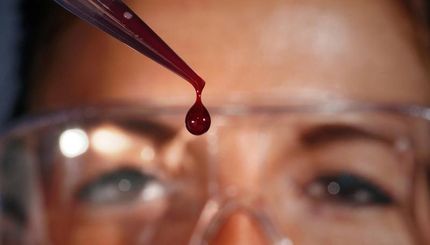 Wie viele Zellen verträgt unser Blut?