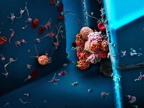 Sauerstoffmangel im Tumor begünstigt die Bildung von Metastasen