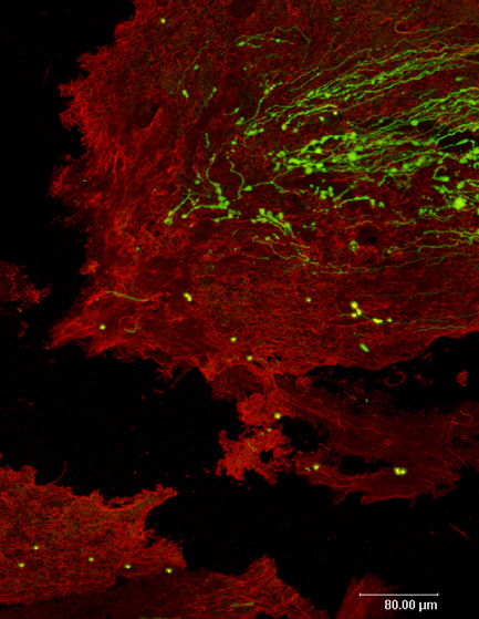 Max-Planck-Institut für Neurobiologie / Bradke