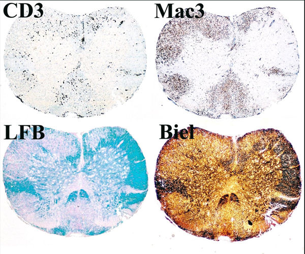 Max-Planck-Institut für Neurobiologie