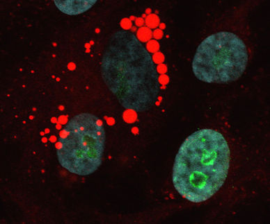 Genetische Lesezeichen programmieren Krebszellen