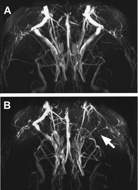 MR Angiography/Copyright: MDC