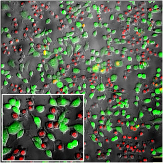 Mit Lasern und Gold-Nanopartikeln Zellen gezielt selektieren