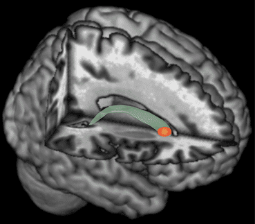 Nucleus caudatus