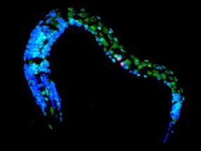 Research team discovers mechanism that restores cell function after genome damage