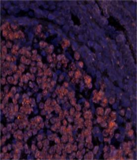 comprehensive analysis of breast cancer