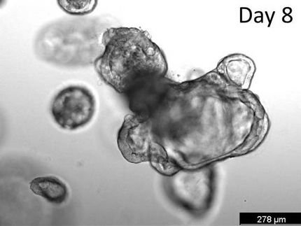 New applications for organoids from human intestinal tissue