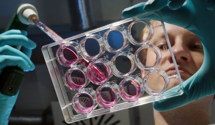 Neuer Krebs-Schalter entdeckt