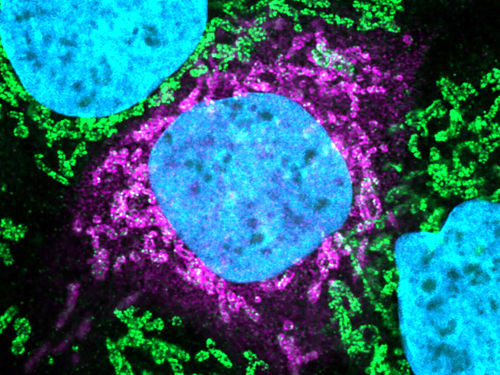 Gemeinsame Schwachstellen von Coronaviren - Internationale Studie kartiert molekulare Ziele für eine mögliche Therapie bei MERS, SARS-CoV1 und SARS-CoV2