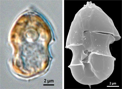 Verursacher von Muschelvergiftungen identifiziert