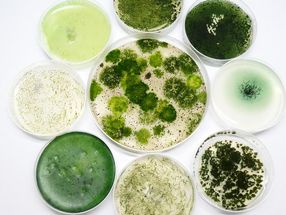 Cyanobacteria: Small candidates as great hopes for medicine and biotechnology
