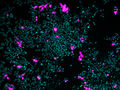 Coronavirus: Study finds further door opener into the cell
