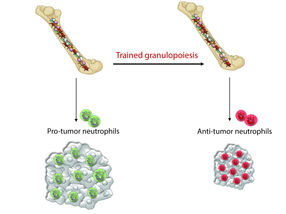 Krebsforscher trainieren weiße Blutkörperchen für Attacken gegen Tumorzellen