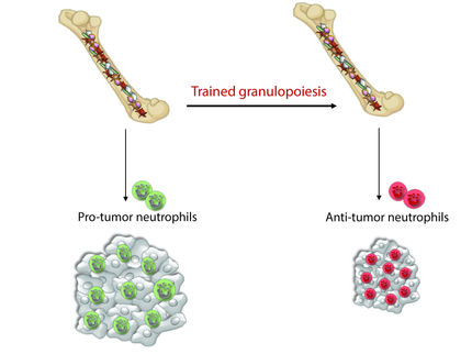 Krebsforscher trainieren weiße Blutkörperchen für Attacken gegen Tumorzellen