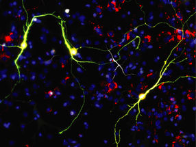 Los investigadores mejoran la reprogramación neuronal manipulando las mitocondrias