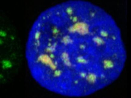 Gerüst von Proteinflecken im Zellkern nach 100 Jahren identifiziert