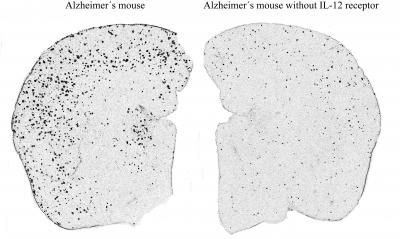 Alzheimer-Erkrankung bei Mäusen gemildert - Aussichtsreicher Therapieansatz für Menschen