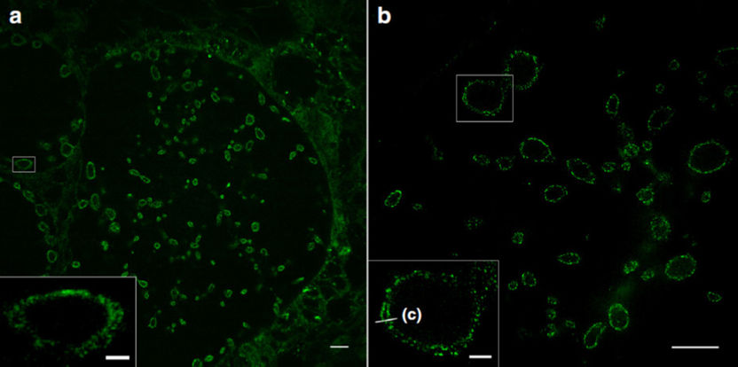 New insights into the release of microplastics from breastmilk