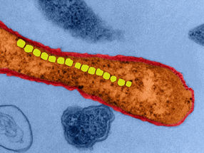 Las bacterias magnéticas como microbombas