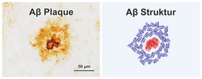 Entwicklung von Alzheimer-Plaques mit Infrarot-Mikroskopie aufgeklärt