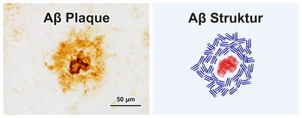 Entwicklung von Alzheimer-Plaques mit Infrarot-Mikroskopie aufgeklärt