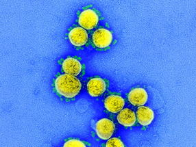 Neuer SARS-CoV-2 neutralisierender Antikörper wird klinisch geprüft