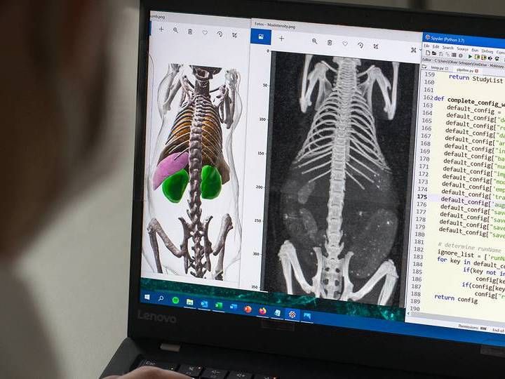 Schneller Blick unter die Haut - Selbstlernende Algorithmen analysieren medizinische Bilddaten