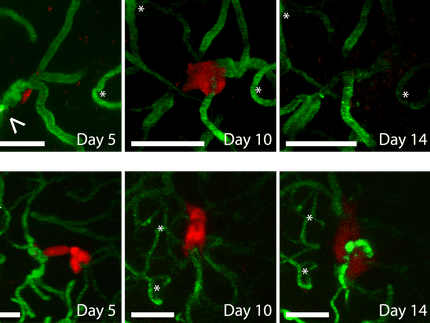 Anticoagulants reduce the number of brain metastases in mice